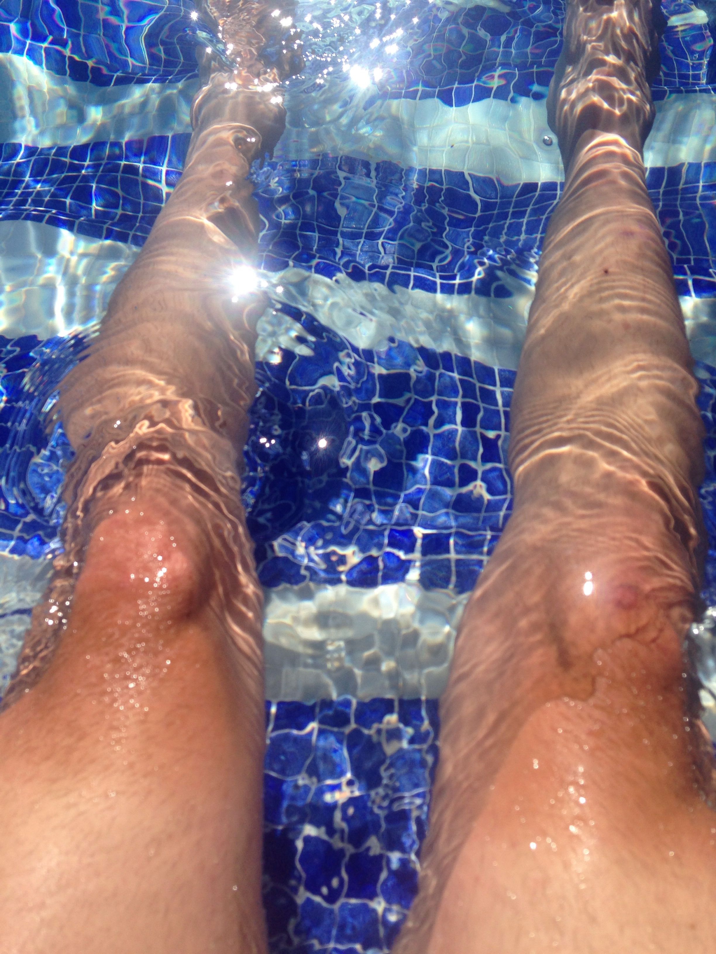 Recuperación tras la etapa 1 de la vuelta ibiza